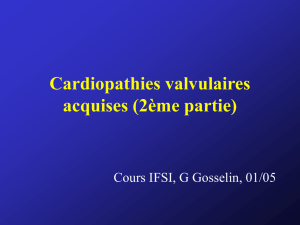 Les cardiopathies valvulaires acquises (2ème partie)