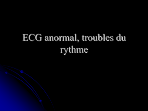 ECG anormal, troubles du rythme