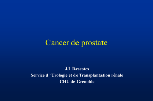 Cancer de prostate localisé et localement avancé: Classifications et