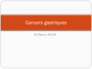 Ulceres-GD_Cancer-gastriques