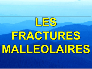 LES FRACTURES MALLEOLAIRES