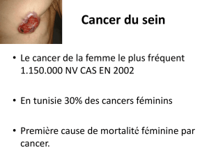 Cancer du sein - SMGT Médecins généralistes