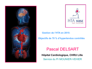 HTA - smd douai
