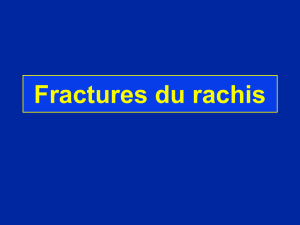 Fractures du rachis