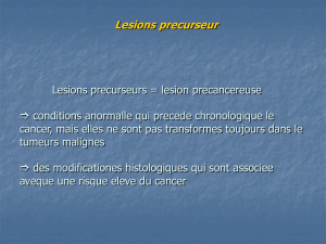 PROPHYLAXIE DU CANCER Premises theoretiques : 1. Etiologie