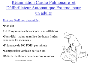 Réanimation Cardio Pulmonaire et Défibrillateur Automatique