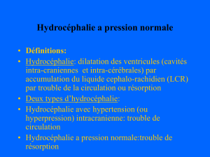 hydrocephalie a PN