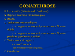 gonarthrose