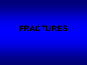 fractures - Cours ITO