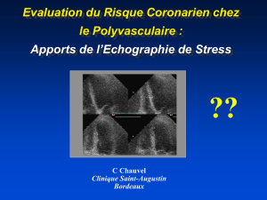 Echocardiographie de stress et angioplastie coronaire