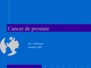 cancer_de_prostate_St_Jo_X