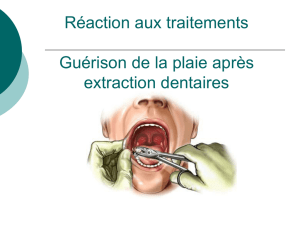 Chapitre XV Réactions suite à certains traitements dentaires