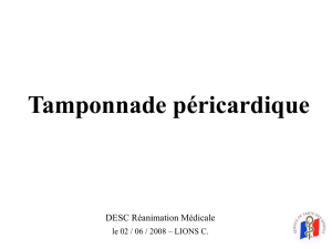 Tamponnade péricardique - DESC Réanimation Médicale