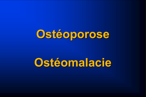 L`Ostéoporose - le site de la promo 2006-2009