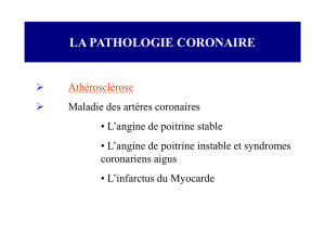 Pathologies coronaire