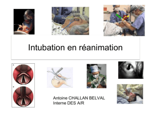 Intubation en réanimation