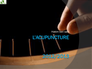 l*acupuncture