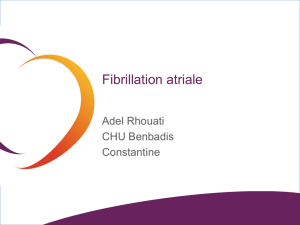 Fibrillation atriale