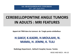 cerebellopontine angle tumors in adults : mri features