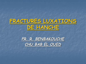 FRACTURES LUXATIONS DE HANCHE