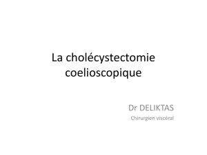 La cholécystectomie coelioscopique