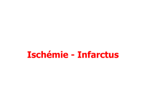 Ischémie - Infarctus