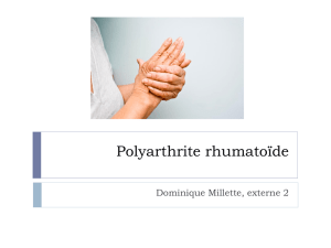 La polyarthrite rheumatoïde
