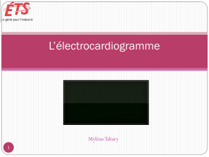 L*électrocardiogramme