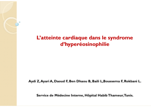 L`atteinte cardiaque dans le syndrome d`hyperéosinophilie