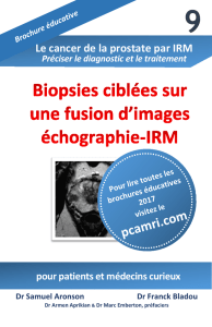 9-Biopsies ciblées basées sur une fusion d`images