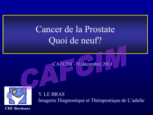Imagerie cancer prostatique