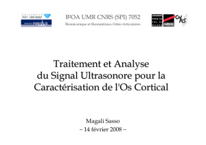 Traitement et Analyse du Signal Ultrasonore pour la Caractérisation