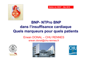 BNP- NTPro BNP dans l`insuffisance cardiaque Quels marqueurs