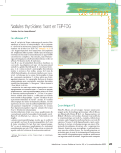 Nodules thyroïdiens fixant en TEP-FDG