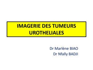 imagerie des tumeurs urotheliales