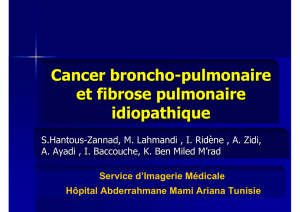 Cancer broncho-pulmonaire et fibrose pulmonaire idiopathique