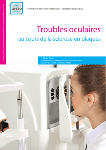 Troubles oculaires