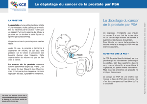 Le dépistage du cancer de la prostate par PSA Le dépistage