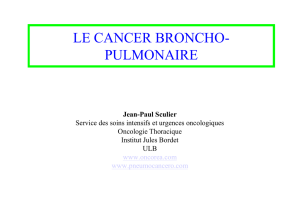 LE CANCER BRONCHO- PULMONAIRE