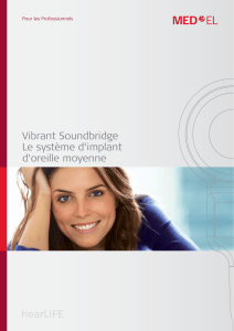 Vibrant Soundbridge Le système d`implant d`oreille moyenne