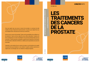 Les traitements des cancers de la prostate