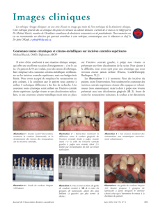 Images cliniques - Canadian Dental Association