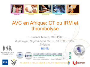 AVC en Afrique: CT ou IRM et thrombolyse