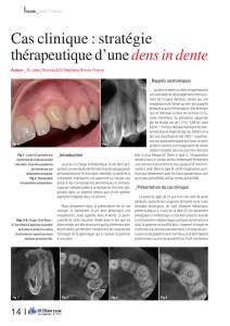 dens in dente - Dental Tribune International