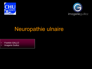 Neuropathie Ulnaire