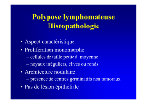 Lymphome T - oncopathologie
