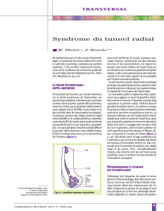 Syndrome du tunnel radial