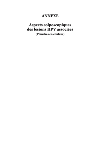 ANNEXE Aspects colposcopiques des lésions HPV associées