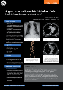 Angioscanner aortique à très faible dose d`iode Perfusion pulmonaire
