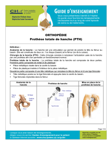 Prothèse totale de la hanche (PTH)
